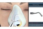 Piezotome M+ for Ultrasonic Rhinoplasties - Video