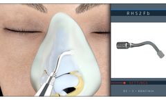Piezotome M+ for Ultrasonic Rhinoplasties - Video