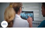 IRIS: Implant Real-time Imaging System - Video