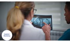 IRIS: Implant Real-time Imaging System - Video