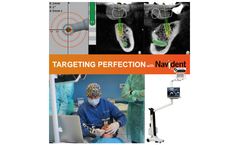 Navident - Dynamic Navigation for Dental Implantation Brochure