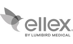 Selective Laser Trabeculoplasty Services