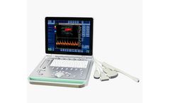 SonoStar - Model C2 - Color Doppler Ultrasound System