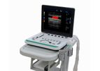 Model C5Pre Laptop - Color Doppler