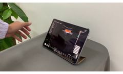 Wireless 3 in 1 Ultrasound Scanner SIFULTRAS-3.3 Triple Headed: Convex, Linear and Cardiac Probe - Video