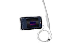 SIFSOF - Model SIFULTRAS-1.3 - Color Transvaginal Ultrasound Scanner 6 Inch Touch Screen, 4-9 MHz