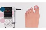 DMX Digital Vascular Dopplers - Video