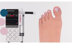 DMX Digital Vascular Dopplers - Video