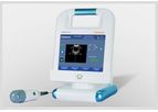 Caresono - Model PadScan HD5 - Bladder Scanner