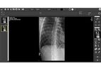 Magellan - Medical Image Processing Software