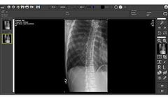 Magellan - Medical Image Processing Software