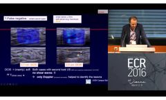 ECR 2016 Symposium - Clinical Innovations Improving Breast Cancer Diagnosis - Prof. Schäfer - Video