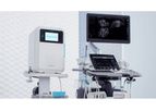 Nanosonics - Model trophon2 - Automated Ultrasound Reprocessing Systems
