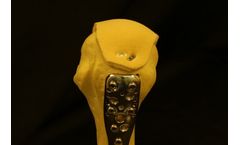 Bonutti TRANSET - Fracture Fixation System