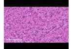 NIO - Laser Imaging System - Video