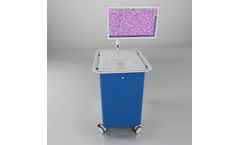 NIO Laser Imaging System