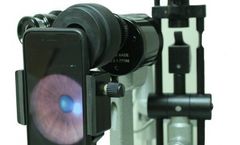 ACCU-BEAM - Universal Smartphone Adapter