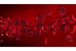 Understanding Stroke - Video