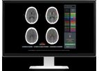 Rapid Aspects - Automatic Identification Software