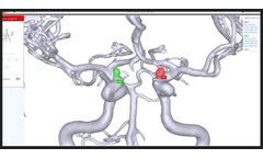 RAPID Aneurysm - Comprehensive Aneurysm Management Software