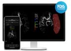 Rapid - Version CTA  and LVO - Fast Identification of Suspected Software