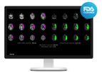 RapidAI - Version CTP - Advanced CT Perfusion Analysis  Software