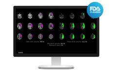 RapidAI - Version CTP - Advanced CT Perfusion Analysis  Software