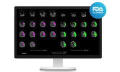RapidAI - MRI Diffusion and Perfusion Image Analysis Software