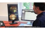 Navilas - Modern Teleguidance Concepts for Navigated Retinal Laser in Clinical Practice - Video