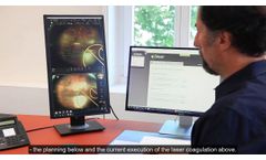Navilas - Modern Teleguidance Concepts for Navigated Retinal Laser in Clinical Practice - Video