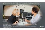 Laser retinopexy: Non-contact navigated laser treatment of a retinal tear with Navilas 577s - Video
