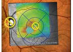 Navilas - Navigated Microsecond Pulsing Software