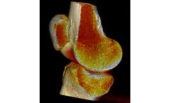 SeeFactor CT3 for Consider Orthopedics (Hips, Knees, Ankles, Bone Density)
