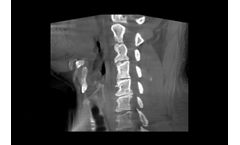 SeeFactor CT3 for Consider Cranial and Spine
