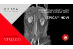 Identifying Kidney Mass in Canine patient with Epica HDVI - Video