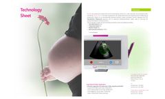 SensUS Touch - Echographic Medical Device Technical Data Sheet