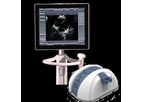 SensUS View - Echo Color Doppler Systems