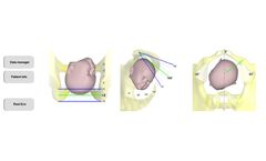 Amolab Suite - Software for Automatic Monitoring of Childbirth