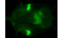 Clinicians  - FIRE – A Flexible and Precise Molecular Probe Platform Expressly Designed for Cancer Surgeons