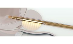 TULSA-PRO - Inside-Out Prostate Disease Ablation System