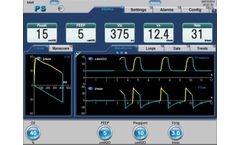 Ventilators for Noninvasive Ventilation