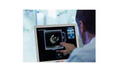 ACIST - Model HDi - High-Definition IVUS System