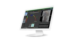 Medis - Version QFR - Quantitative Flow Ratio Software