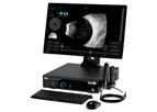Escalon - Model VuMAX HD - Ophthalmic Ultrasound System