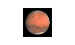 MARS - MRI Assisted Radiosurgery
