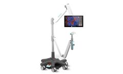 DYSISmap - Clinically-proven Digital Colposcope Software