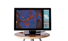 DYSIS View - Colposcope Software
