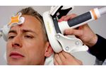 Nexstim navigated TMS is helping make brain surgery safer - Video