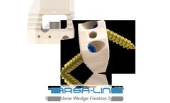 TARSA-LINK - Stand-Alone Wedge Fixation System