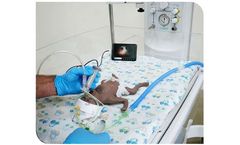 NeoView - Neonatal Video Intubation System